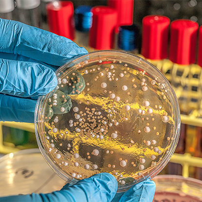 การควบคุมสุขภาพและโรค